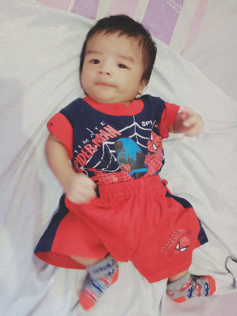 cradle cap atau apa?