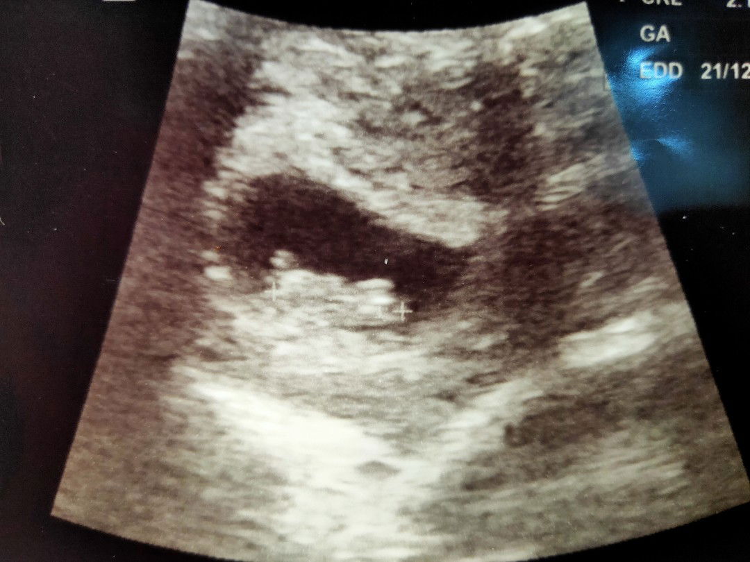 Irend Ajizah profile icon