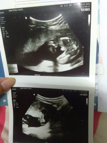 ดูรูปล่างไม่รู้เรื่องเลย