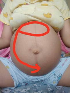 เป็นอะไรก็ไม่รู้