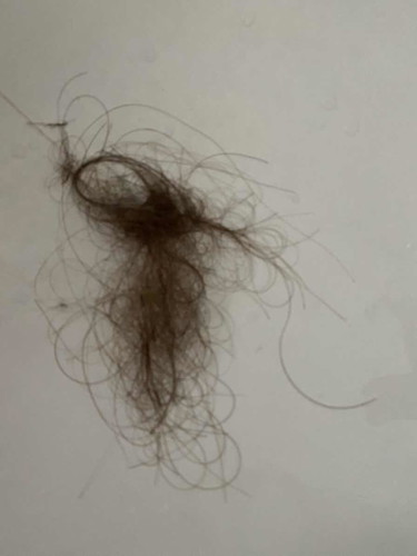 แม่ผมร่วง