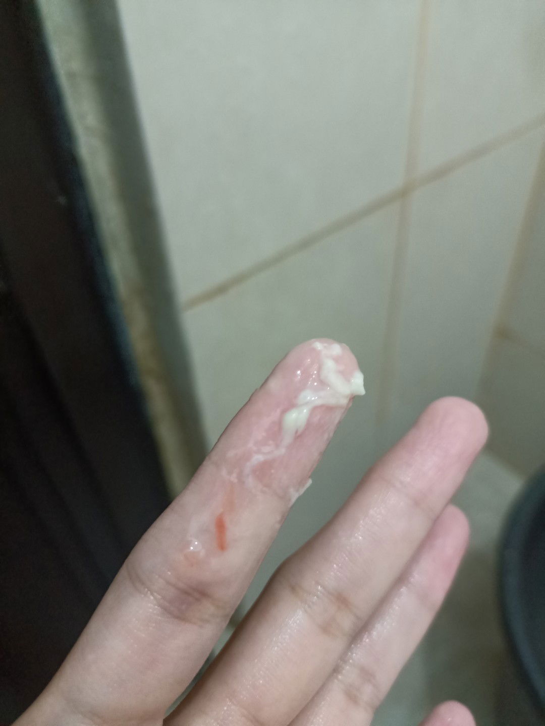 Keputihan dan bercak