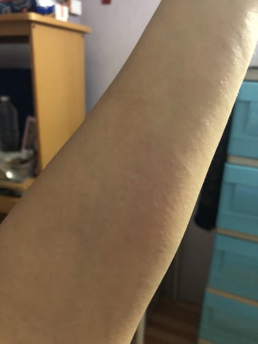 DAHIL PO BA SA INIT TONG PARANG BUTLIG?