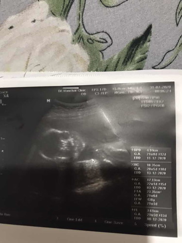 ตั้งครรภ์