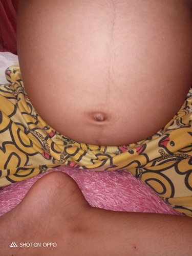 ่ท้องแบบนี้ ผู้หญิงหรือผู้ชายคะ