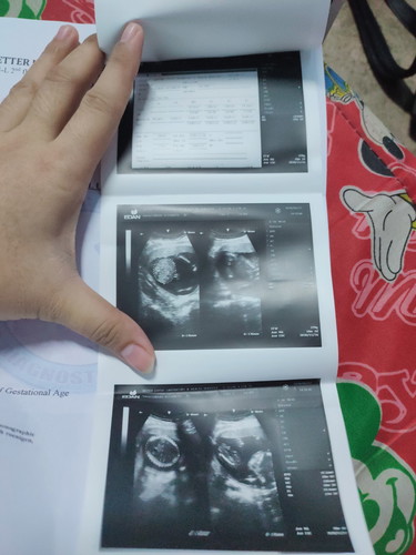 Ultrasound