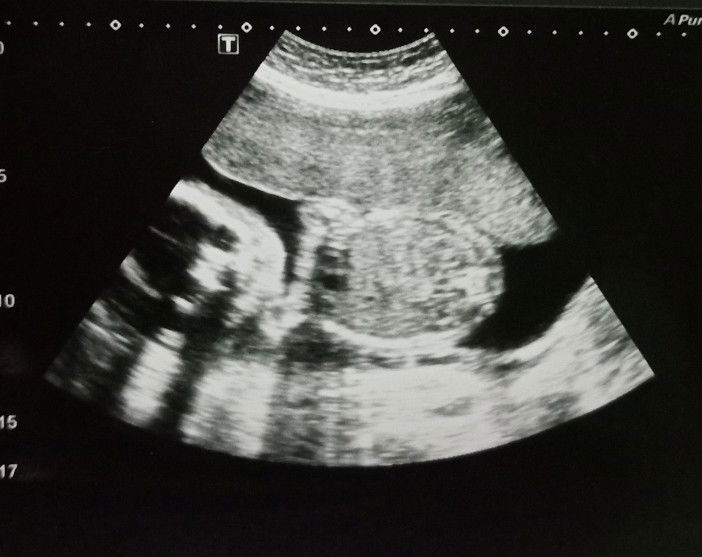 Michelle Buenaventura profile icon