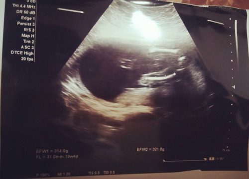 ตั้งครรภ์