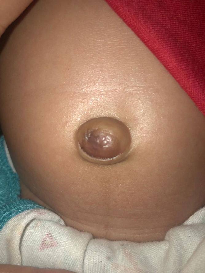 Assalamualaikum bunda