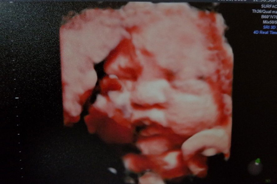 Mariel Cayangho-Balingbing profile icon