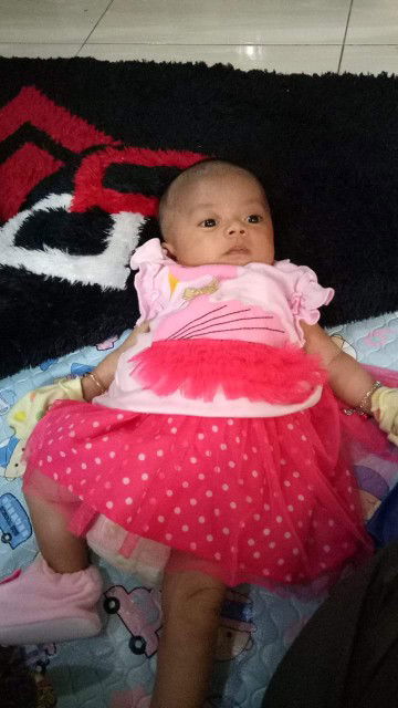 ukuran kepala bayi