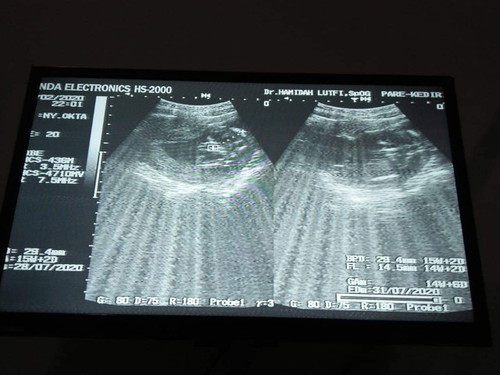 saya ingin lihat perkembangan janin saya