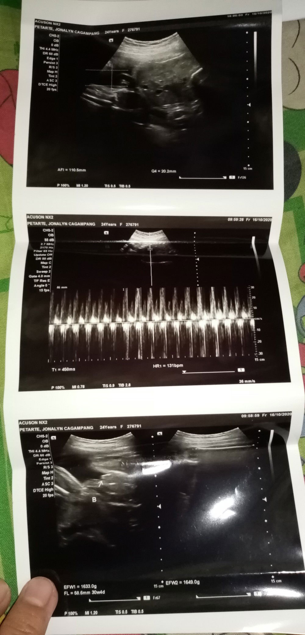 Christlyn Cagampang profile icon