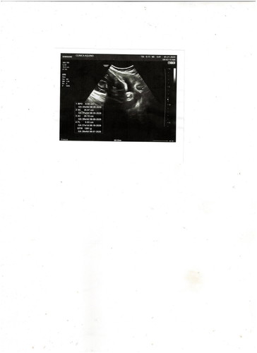 Maternity leave request