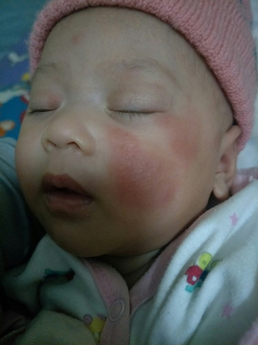 ถามแม่ๆหน่อยค่ะ