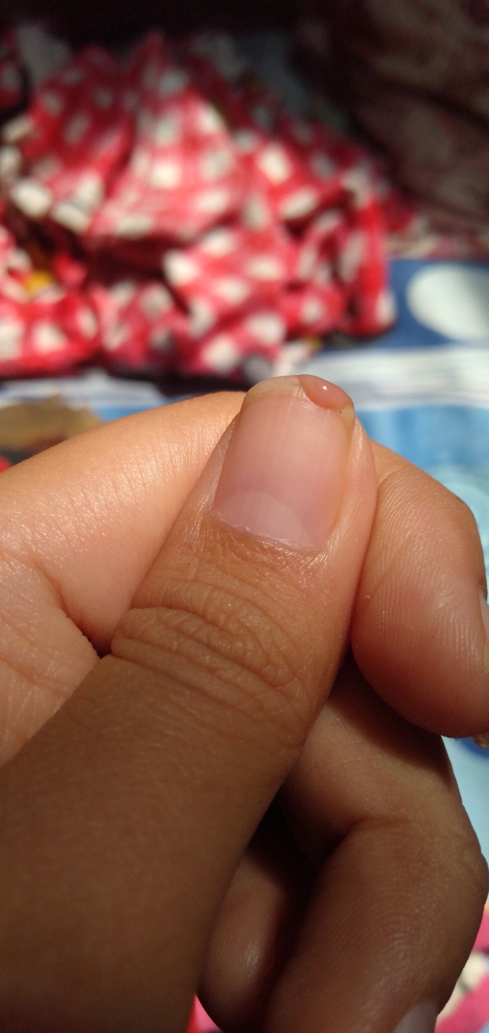 Ini flek menstruasi atau flek implantasi?