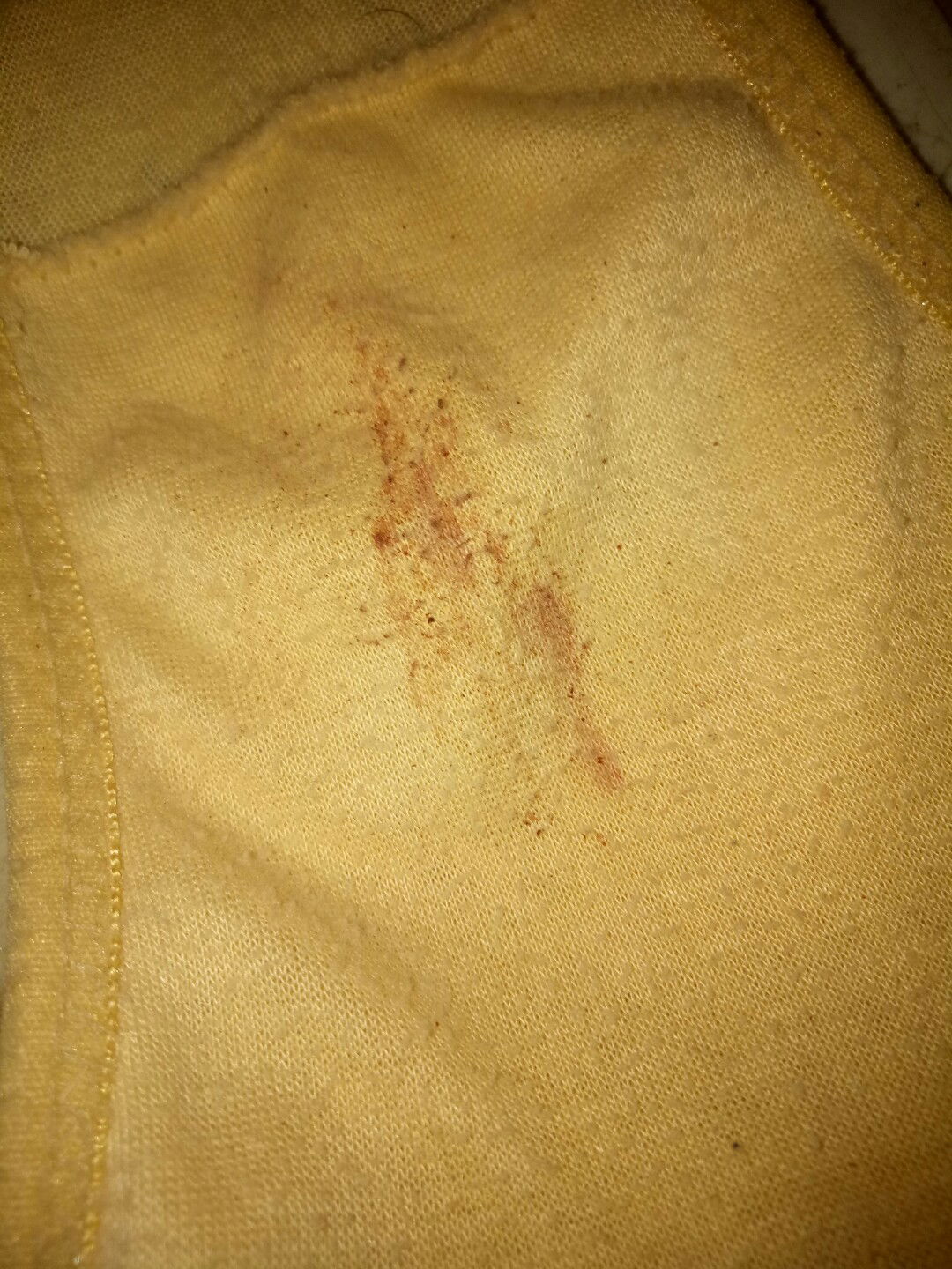 flek coklat dikehamilan 2bulan