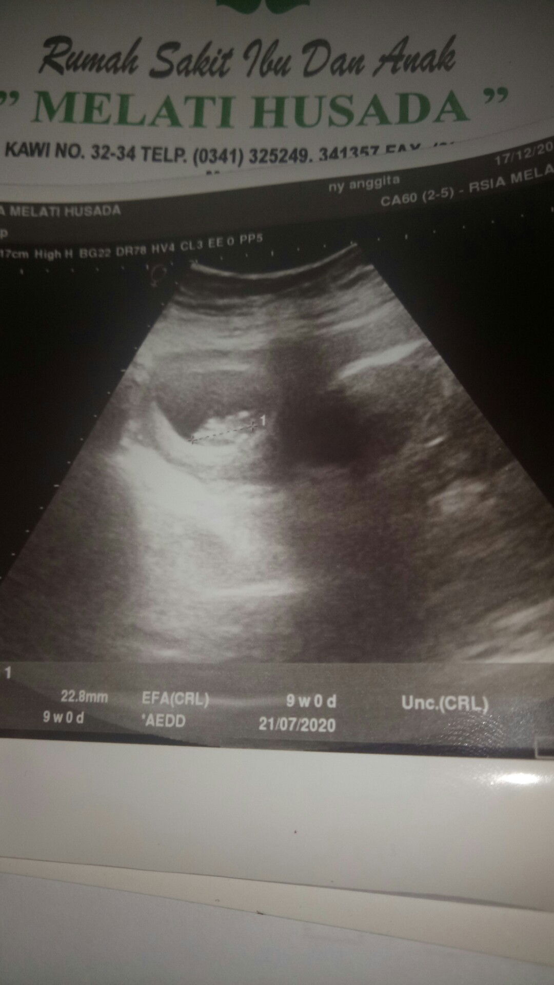 akhirnya diia muncuul