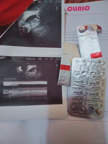 hope na maging okay ang baby ko ?