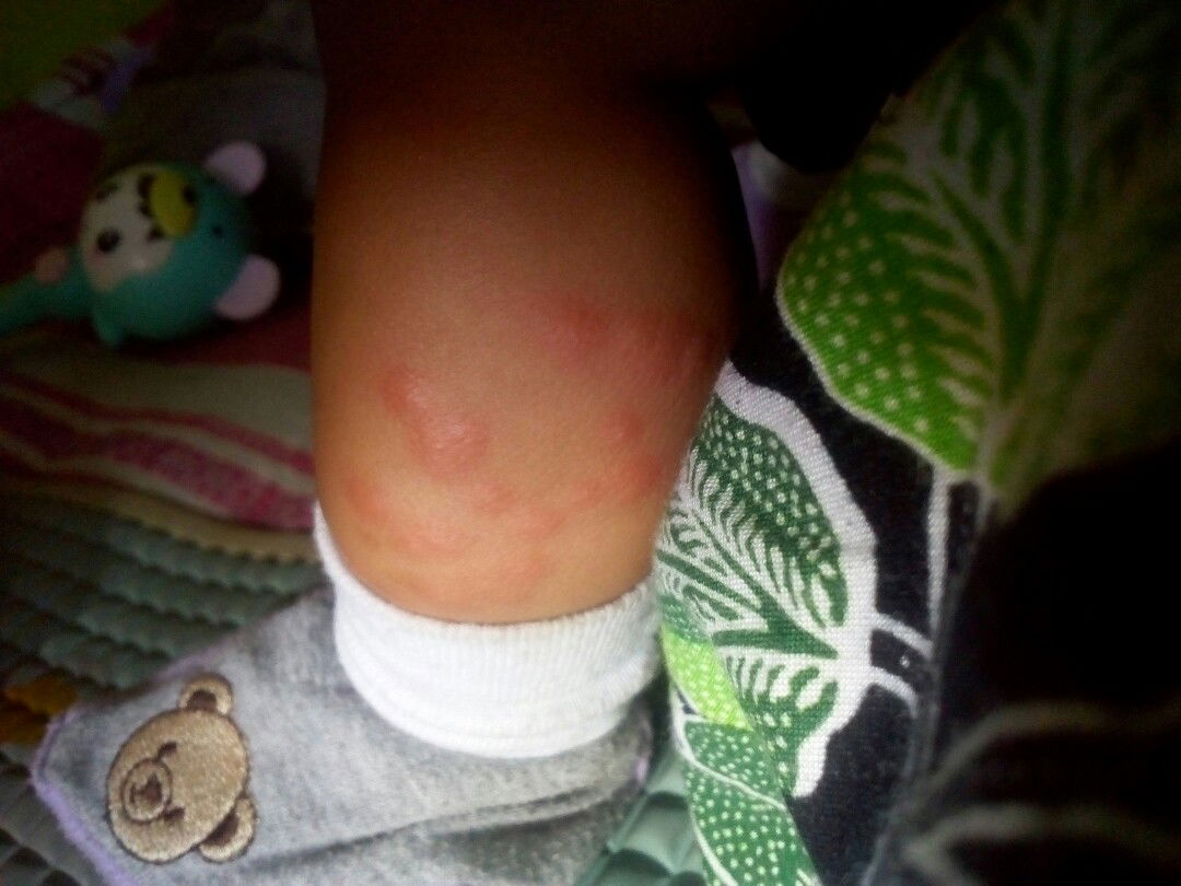 gigigat kutu ranjang