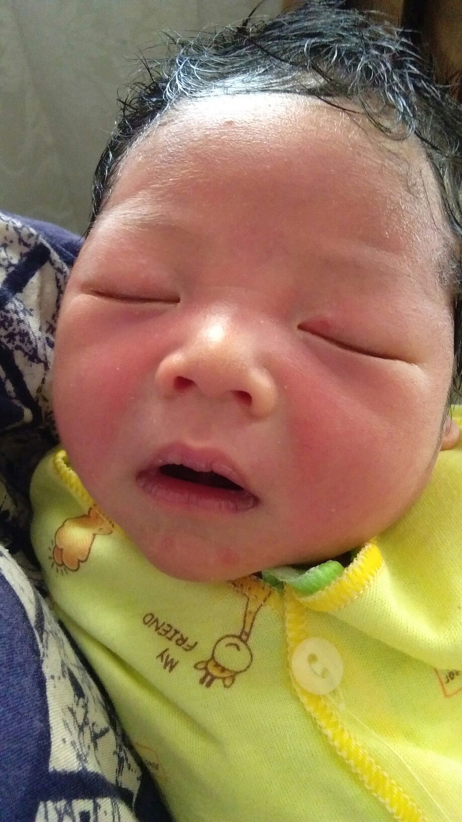 muka bayi merah merah