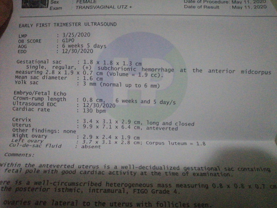 Ganito Ba Talaga Pakiramdam Pagmeron Nito?