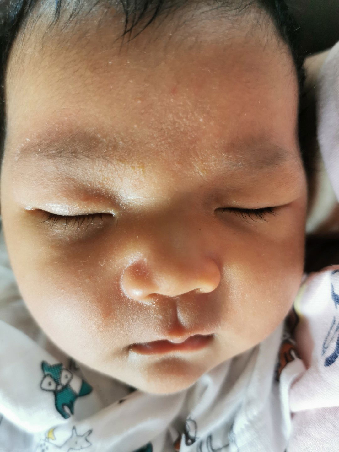 คืออะไรหน้าลูกสาวเป็นแบบนี้