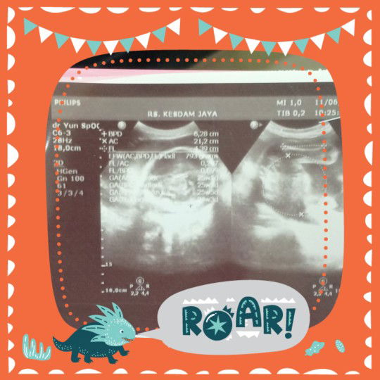 suci putri profile icon