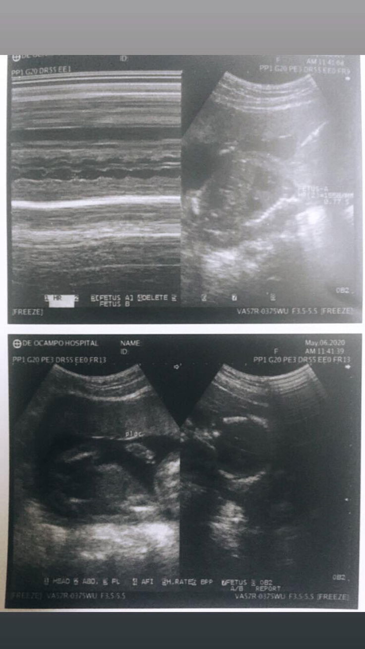 BABY GIRL o BABY BOY?