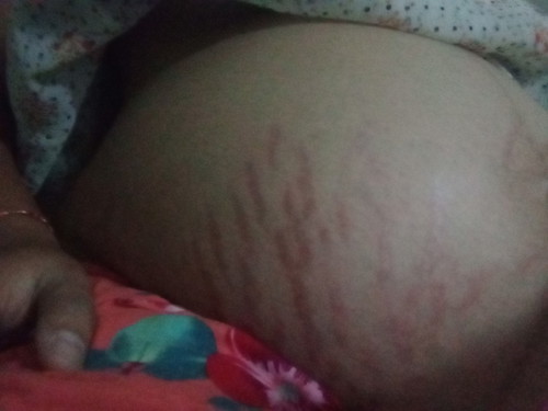 ขำๆค่ะเเตกเยอะเกิน