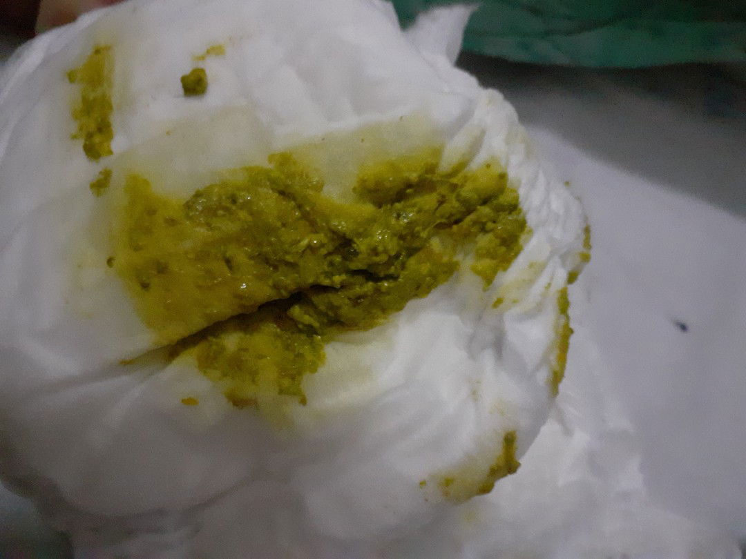 อึลูกเป็นสีเขียวๆเหลืองๆแบบนี้ปกติไหมคะ