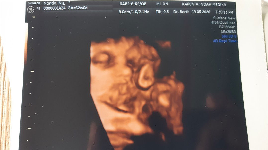 Dara Keumala profile icon