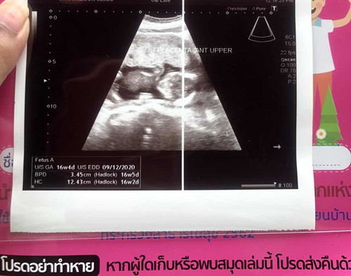 ทีมลูกสาวค่ะ