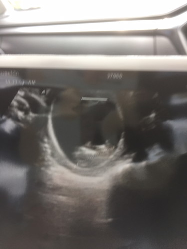 คุณแม่กำหนดคลอดเดือนมกราคม