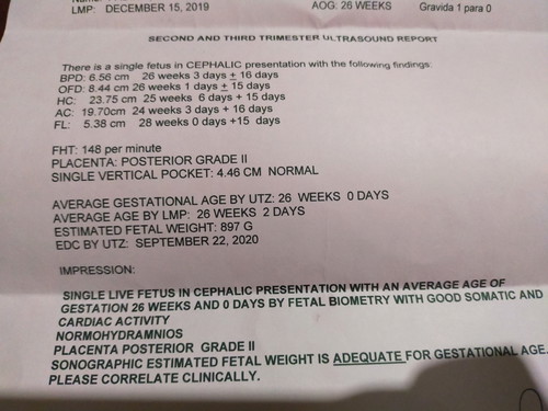 Normal lang po ba?