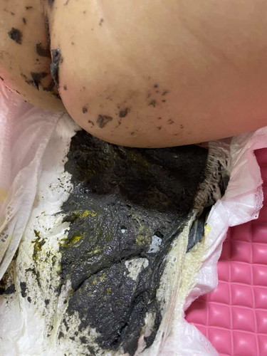 Poo colour