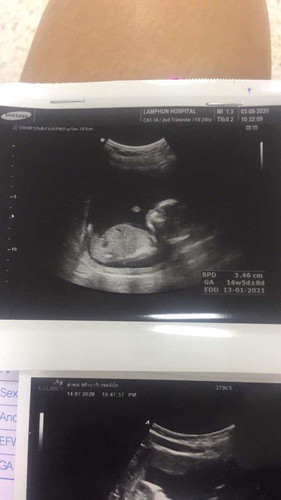 น้องได้16 w แล้วแม่ๆว่าน้องอ้วนไปไหมคะ