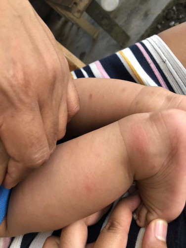 Anong dapat gamiting baby lotion