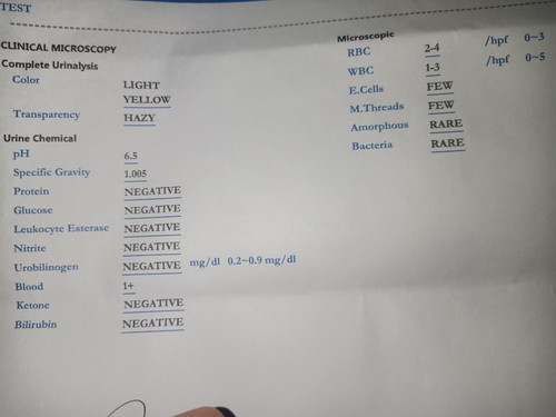 test urine.