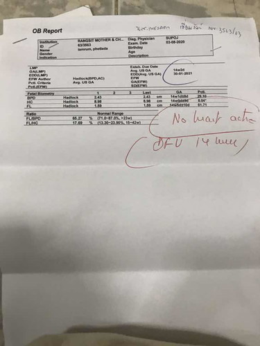 18 วีค. วันนี้คุณหมอยุติการตั้งครรภ์. เนื่องจากซาวด์แล้วพบว่าน้องหัวใจหยุดเต้น หยุดการเจริญเติบโตตั้งแต่14วีค สาเหตุมาอะไรไม่รู้ หมอได้แต่สัณนิฐานว่า เป็นเพราะโครโมโซมผิดปกติ เด็กมีอาการบวมน้ำ