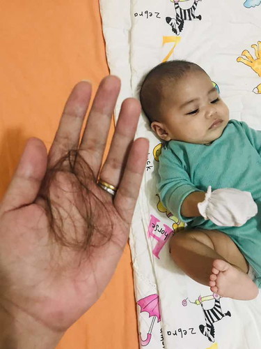 Hairfall Everyday😔