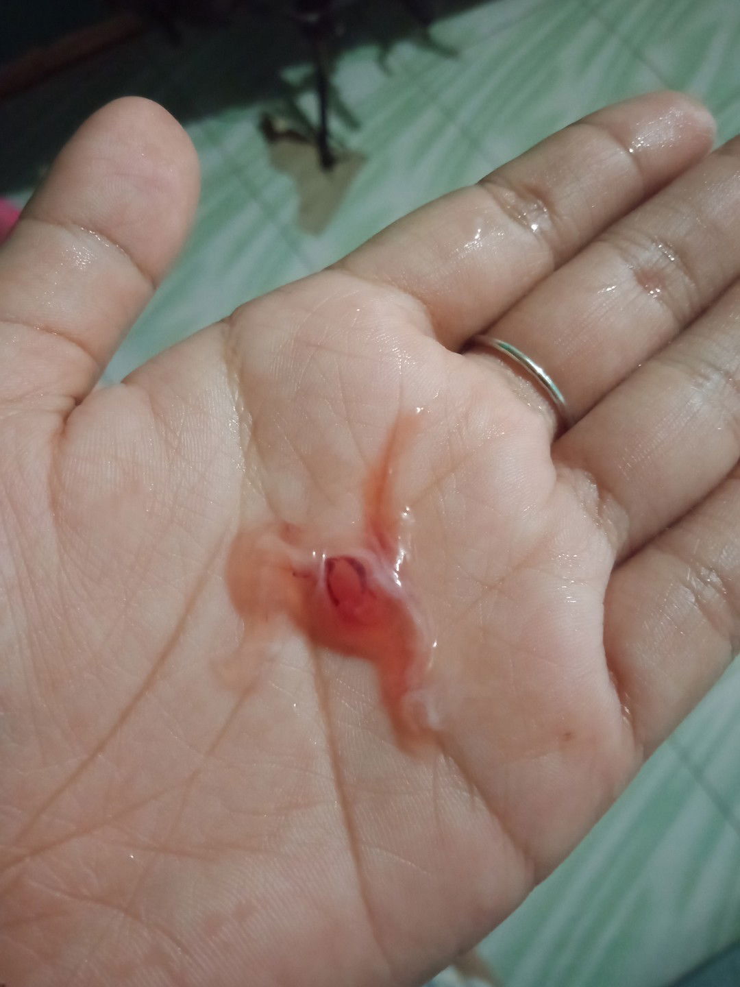 lendir campur darah trimester 1