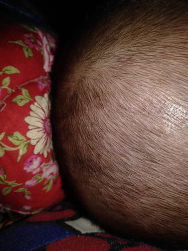 bentol merah dikepala