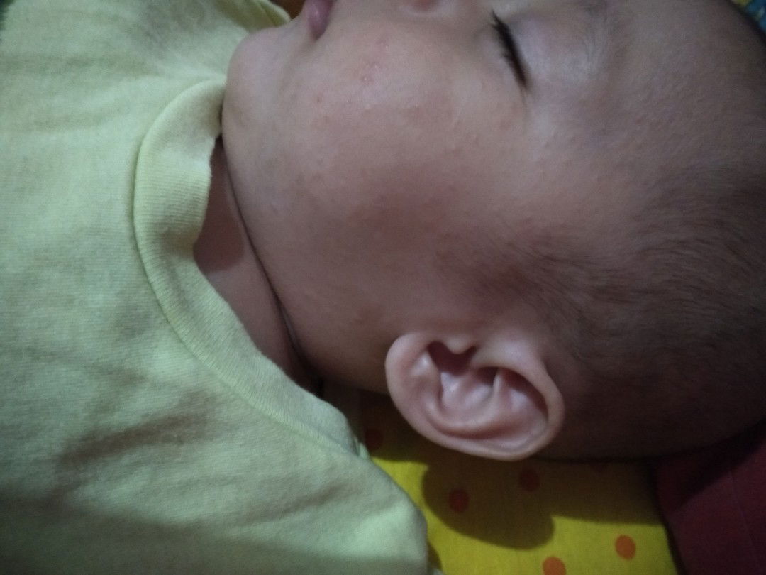 biang keringat bukan