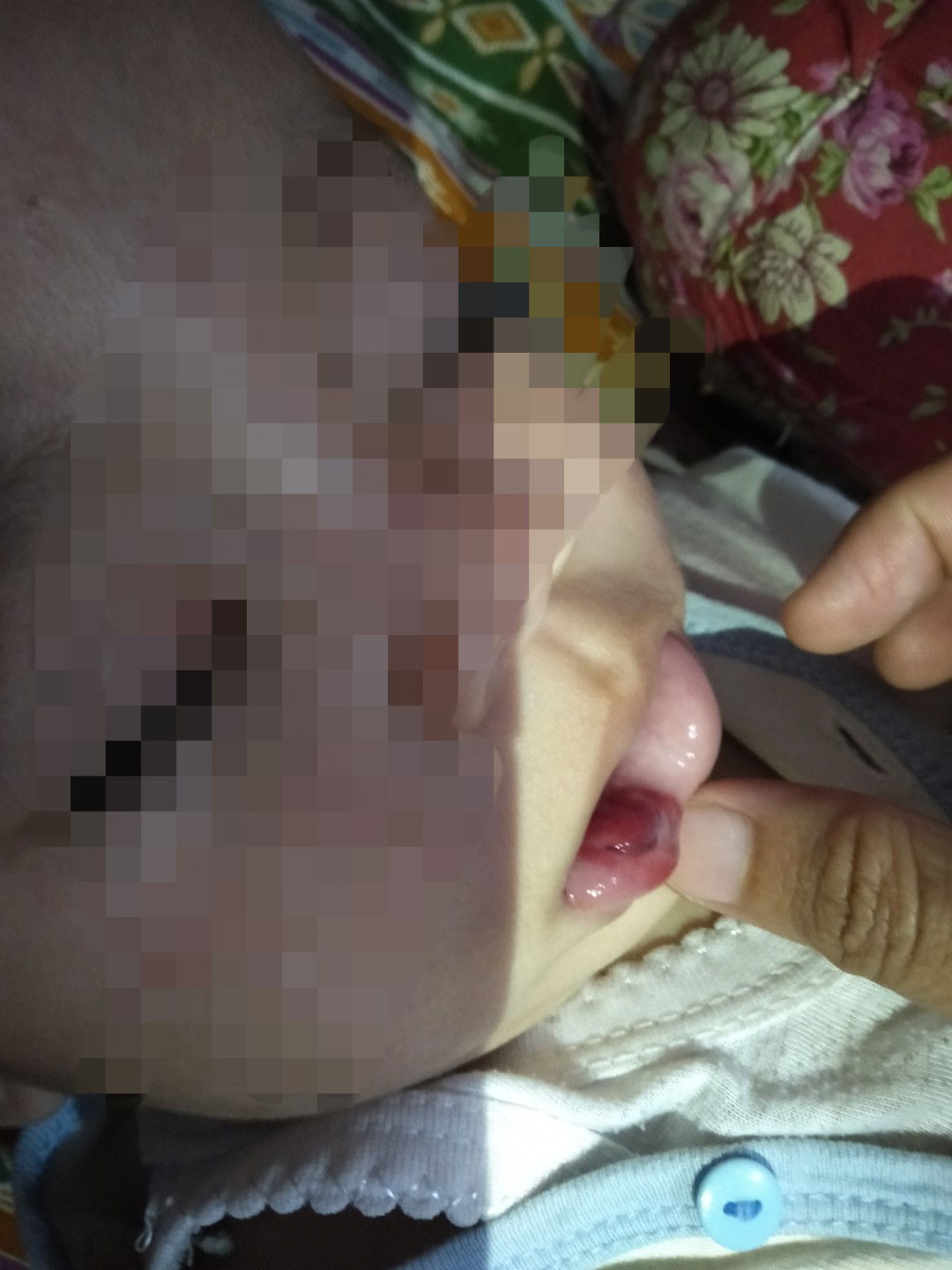 Obat alami apa biar cepat sembuh