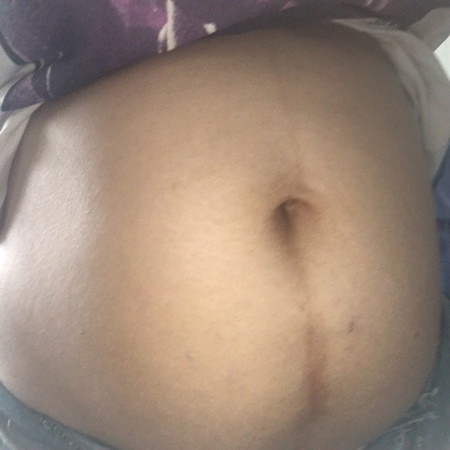 อยากรู้เพศลูก