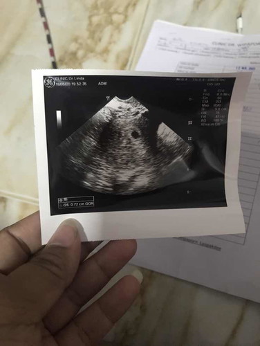 อยากได้คำตอบจากแม่ๆค่ะ