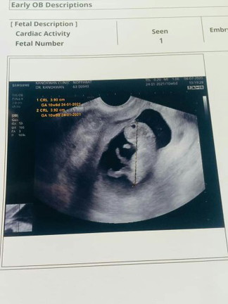 10w6d