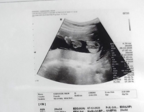 แม่ๆว่าเพศหญิงหรือชายคะ