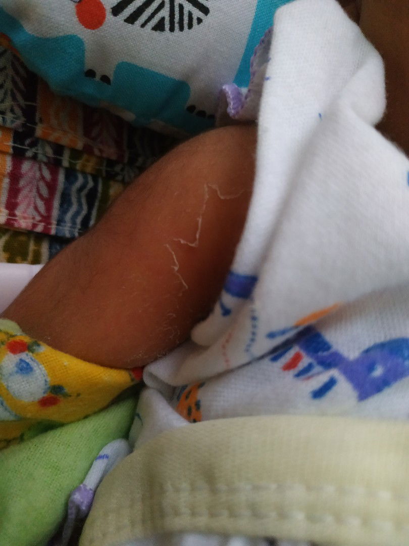 ganti kulit (new born)